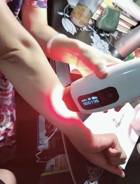 可思美cosbeauty光子脱毛仪效果怎么样?可思美IPL光子脱毛仪使用感受! 可思美cosbeauty光子脱毛仪效果怎么样?可思美IPL光子脱毛仪使用感受!